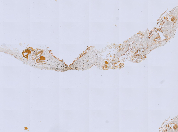 Mikroskopisches Bild eines formalin/PFA-fixierten Paraffin-embedded Gewebeschnitts, der mit anti-PFA1-Antikörper (EPR22828) und BSA gefärbt ist.