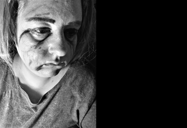 Schwarzes und weißes Foto einer Frau mit sichtbaren Gesichtsverletzungen, ernster Miene, konzentriertem Blick, zurückgebundenem Haar, T-Shirt tragend.