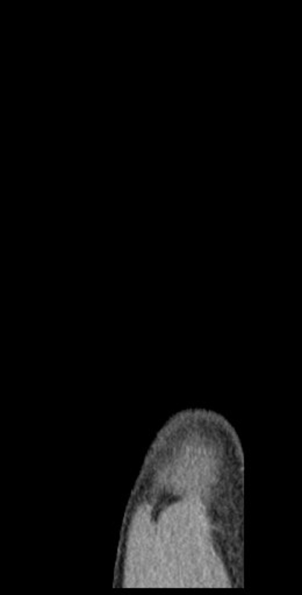 Schwarze und weiße MRI-Aufnahme eines Mannes, die detaillierte Gehirnstruktur zeigt.