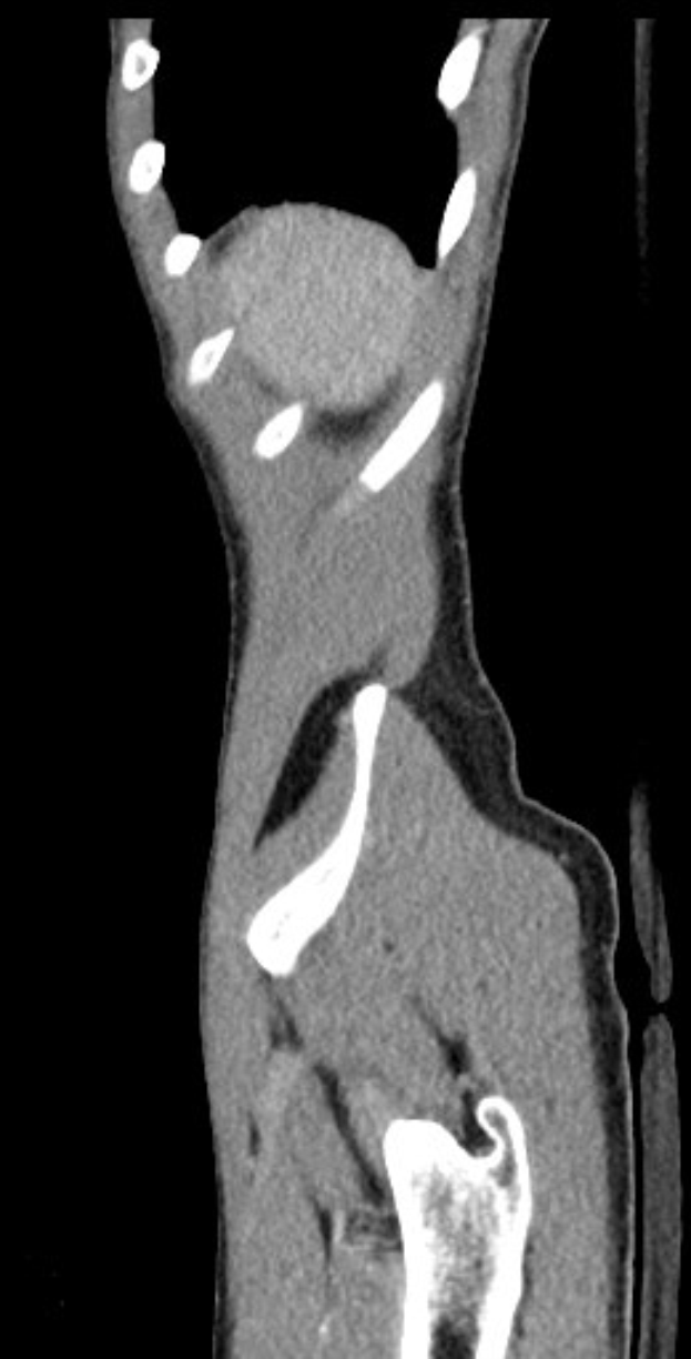 Schwarze und weiße MRI-Aufnahme eines Kniegelenks, die detaillierte Anatomie zeigt.